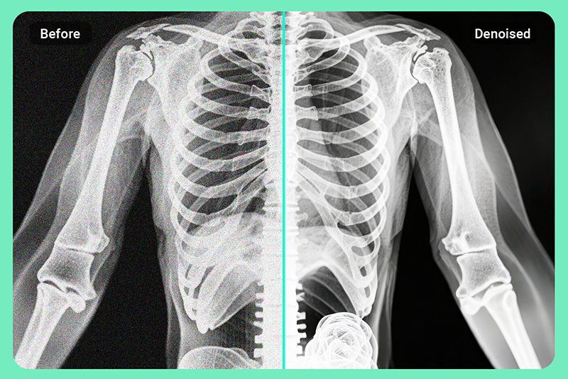 <p><span style="color: #000000;">Fix&nbsp;Scanned&nbsp;Noisy&nbsp;Photos&nbsp;and&nbsp;Medical&nbsp;Records</span></p>