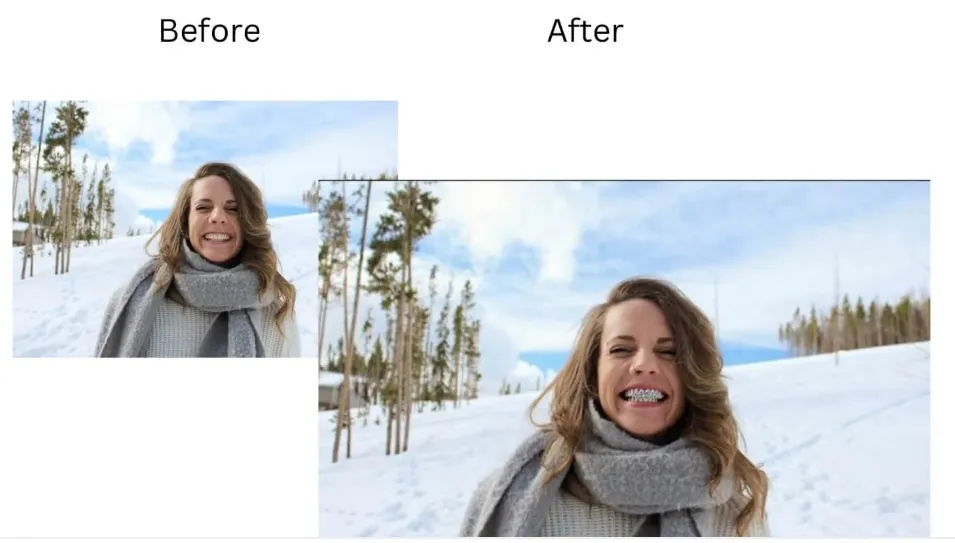 Use braces filter for entertaining TikTok or Instagram prank videos.