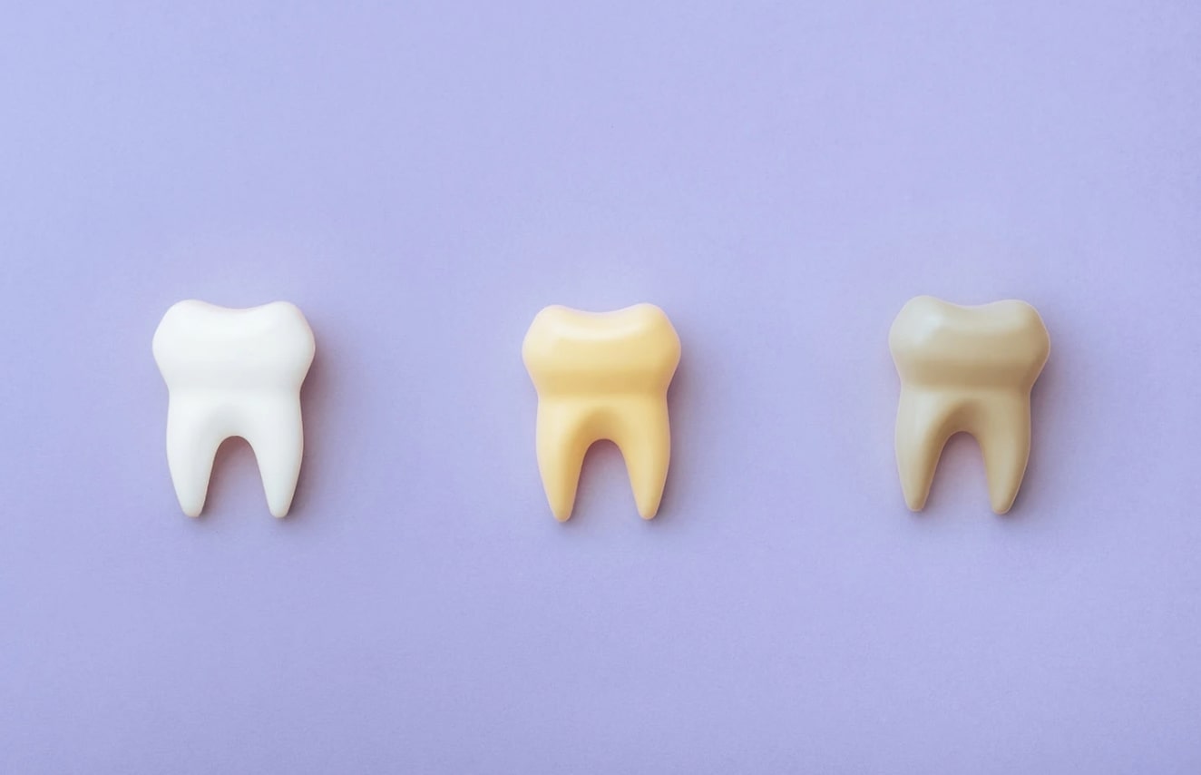 Acidic Compounds Causing Yellow Teeth
