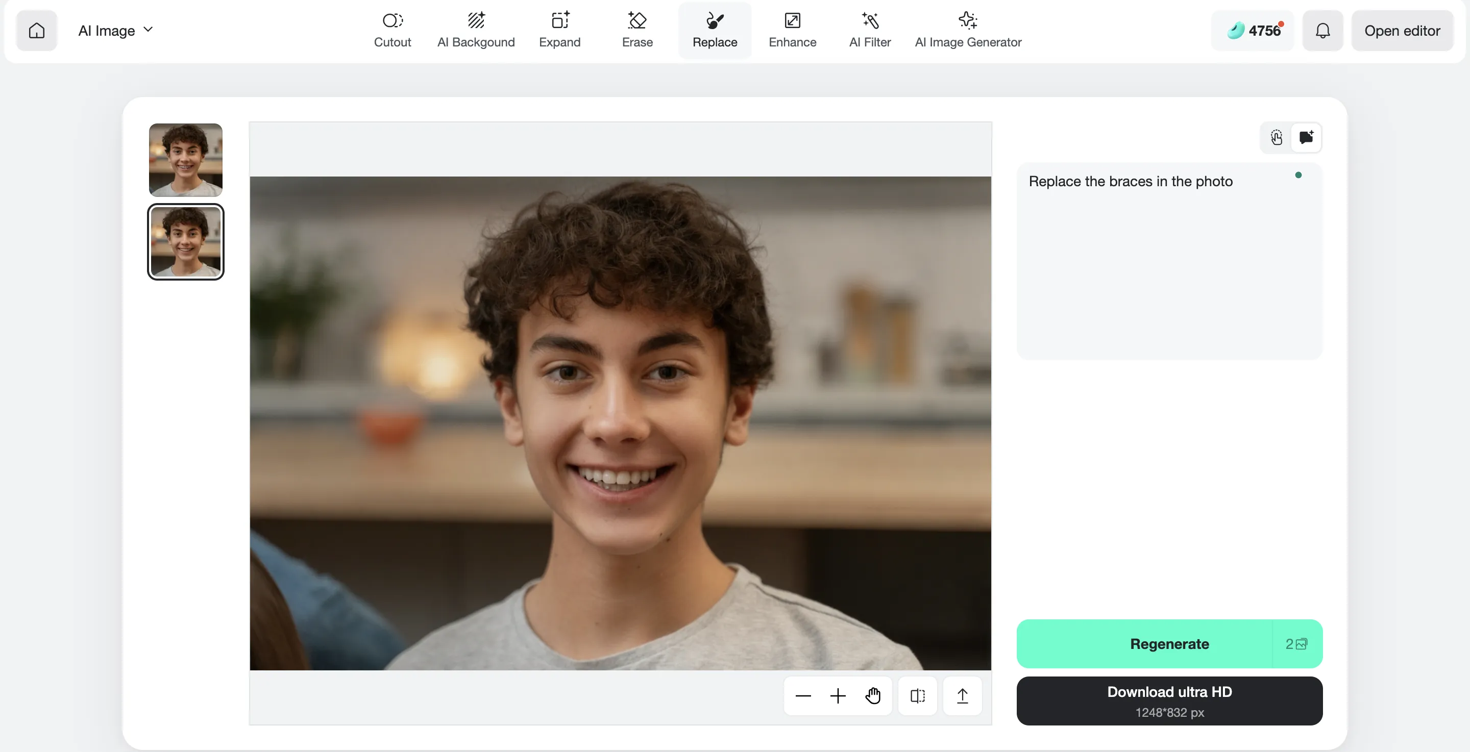  An image showing how to download your braces-free photo in a second.